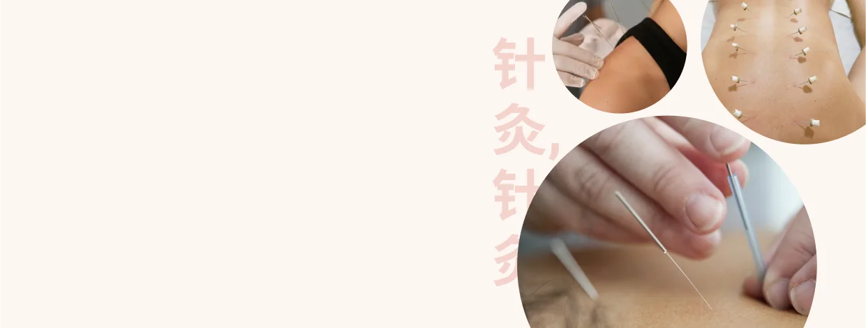 Acupuncture and moxibustion training in China — hands-on practice on the Academy 21 course