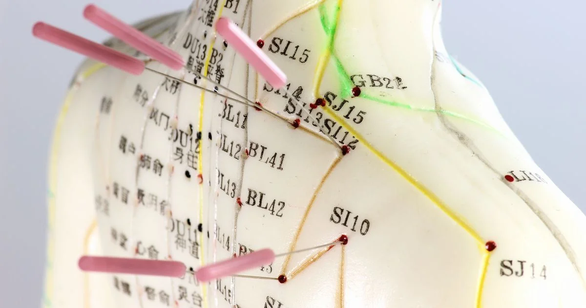 Training in Chinese medicine and acupuncture at Academy 21